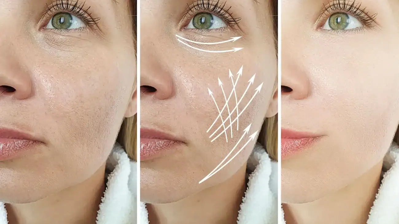 Can One Treatment Really Tackle More Than One Skin Concern Carlton?