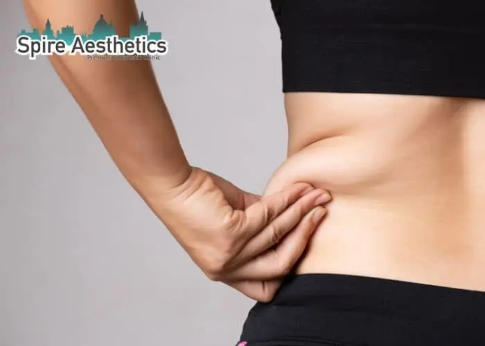 Image of woman pinching fat on their hips Carlton. Fat Freezing treatment