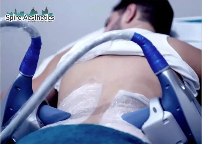 Man having fat freezing treatment done on love handles before a competitions Carlton to create a sculpted look.