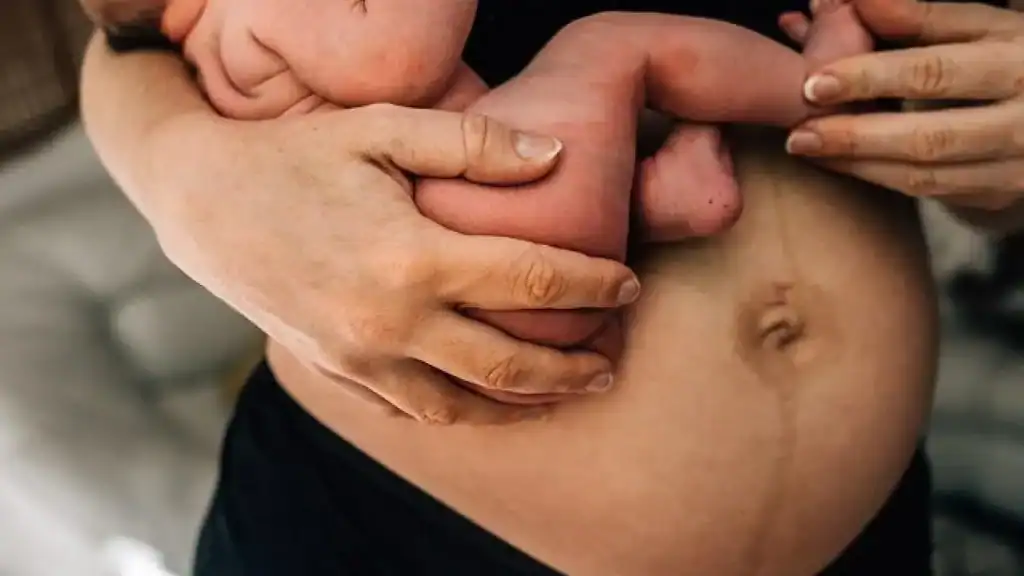 Why Is My Stomach Still Big After Pregnancy Carlton?